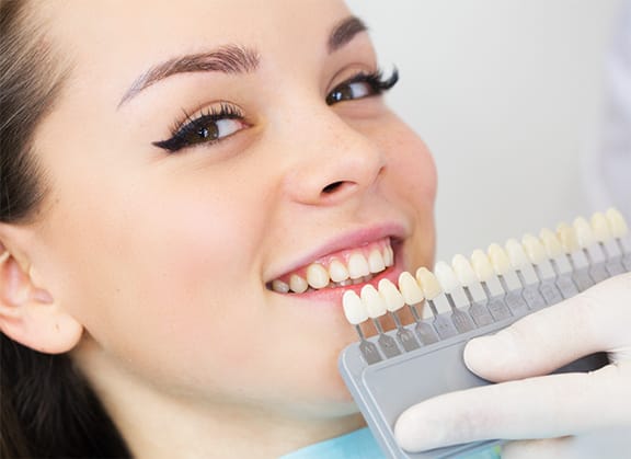 Single Visit Whitening